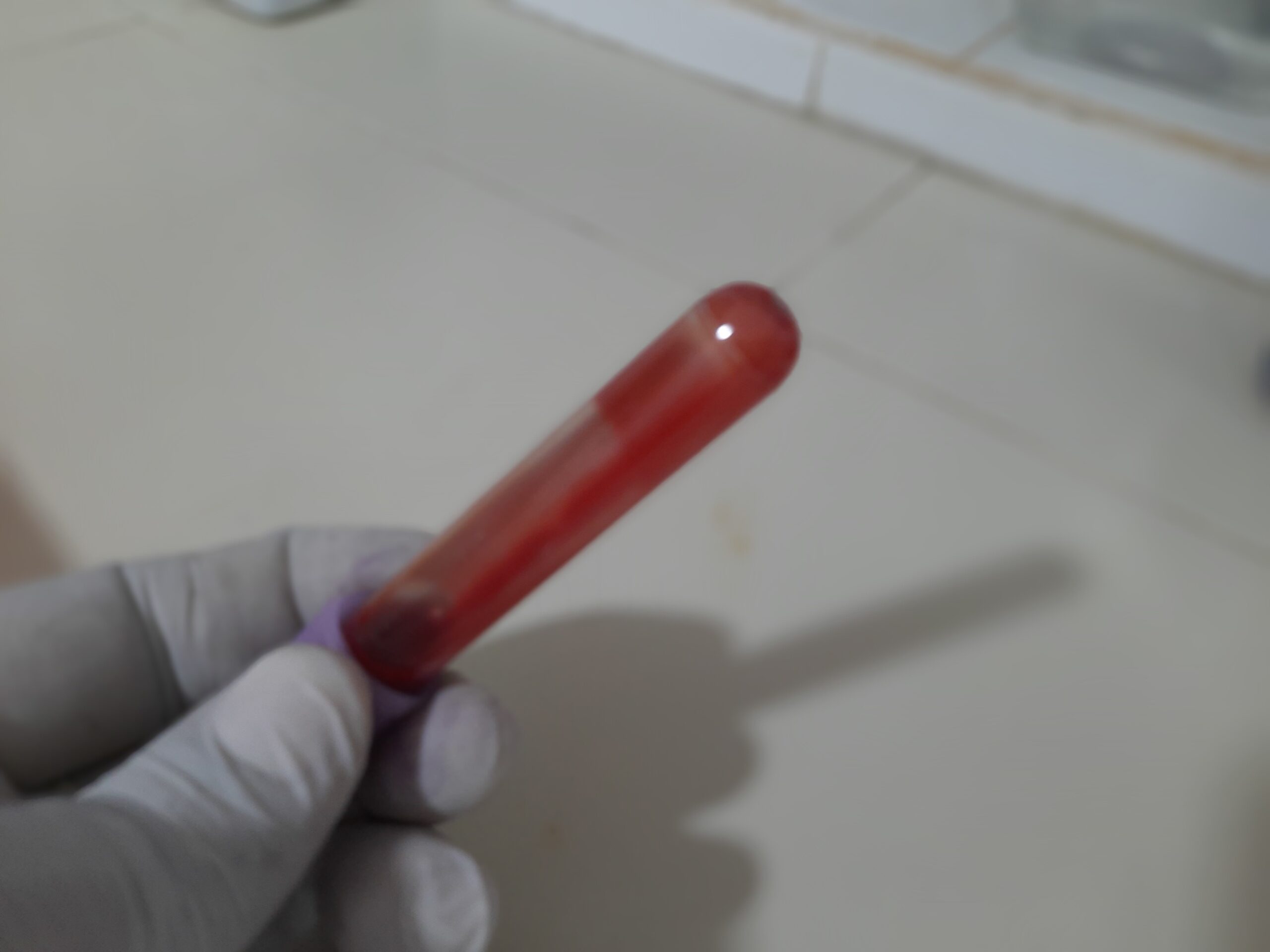 Tubo de coleta com EDTA usado para realizar o hemograma